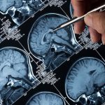 “Amip ăn não” lan rộng tại một bang ở Ấn Độ, tỷ lệ tử vong lên đến 97% avatar1757678842859 1757678843422954336018jpg