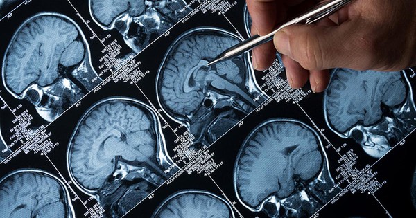 “Amip ăn não” lan rộng tại một bang ở Ấn Độ, tỷ lệ tử vong lên đến 97% avatar1757678842859 1757678843422954336018jpg