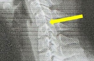 Cô gái 20 tuổi sở hữu cột sống cổ của người 60 vì nghiện chơi game avatar1757911897867 1757911898784728746104jpg