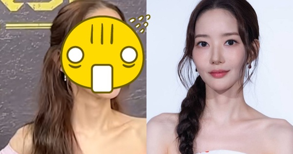 Nhan sắc giả dối của Park Min Young avatar1759366560159 17593665613071393905544 0 0 503 960 crop 17593666293682028568071jpg