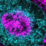 Phát hiện cơ chế “bật năng lượng” khiến tế bào ung thư có thể sống sót avatar1759717764665 1759717765080665714796jpg