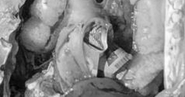 Mổ bụng cá, ngư dân sốc nặng khi phát hiện tiền mặt bên trong avatar1760667445270 1760667445658869459647jpeg