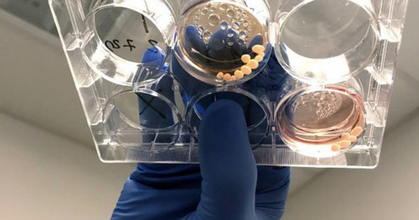 Lịch sử loài người thay đổi vì một chất độc avatar1761107815449 17611078157451347898693 0 60 315 564 crop 17611078397691660778291jpg