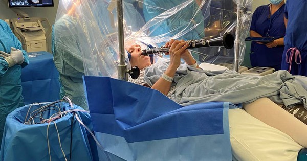 Người phụ nữ thổi kèn trong suốt ca phẫu thuật não kéo dài 4 tiếng avatar1761119654236 17611196551032081793938jpg