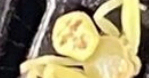 Xuất hiện "nhện mặt người" gây xôn xao cộng đồng mạng avatar1762337985407 1762337985889423597247 0 86 315 590 crop 1762338000909811691208jpg