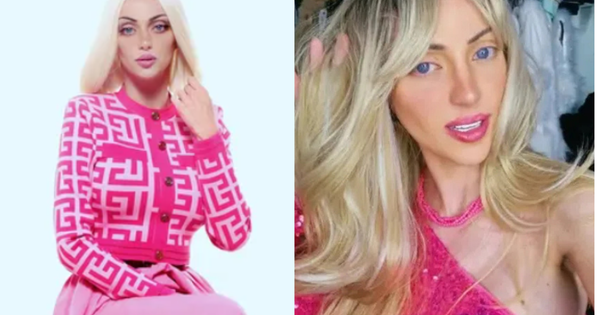 Người mẫu phẫu thuật 27 lần để giống “búp bê sống” tử vong trong tình trạng bất thường tại nhà riêng avatar1762423575010 1762423575674840340542png