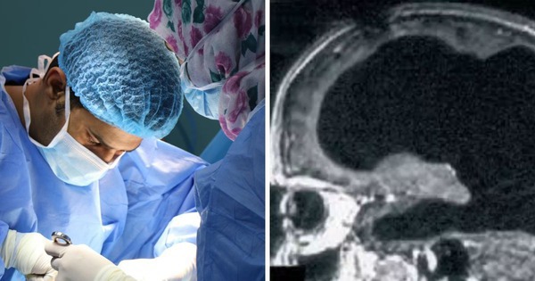 Bí ẩn về người đàn ông mất 90% não, nhưng vẫn có thể sống một cuộc sống bình thường avatar1762521129114 17625211297331014064166jpg
