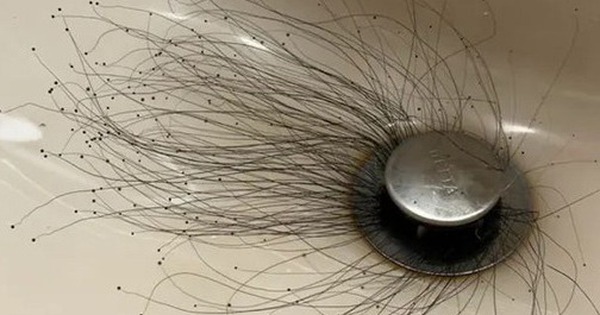 Người đàn ông sốc nặng khi thấy thứ đáng sợ mọc ra từ bồn rửa mặt avatar1762675902591 17626759027951311696131 0 37 315 541 crop 17626759191261860538787jpg