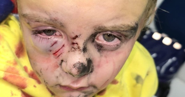 Bé trai 5 tuổi bị chó dữ tấn công khi đang đi dạo ở công viên avatar1763101868417 17631018691421066488429 555 0 1133 924 crop 1763101933875374229809jpg