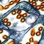 Phát hiện chủng virus cúm gia cầm chưa từng thấy ở người tại Mỹ avatar1763372450340 17633724509661590300653jpg