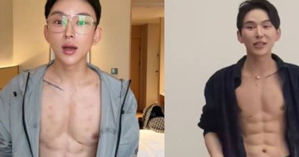 Hot boy chi 14,8 tỷ đồng tiêm axit tạo cơ bụng 8 múi, chuyên gia sợ hãi cảnh báo avatar1763427063810 17634270642521134960597 0 58 275 498 crop 1763427089570238724852jpg