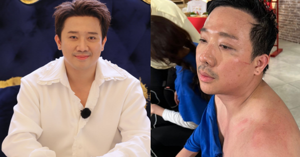 Trấn Thành kiệt quệ avatar1764399176817 17643991773882050107061 0 0 251 479 crop 1764399407402394833286png