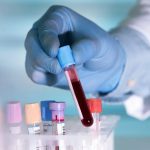 Phát hiện chấn động y khoa: Tìm thấy nhóm máu siêu hiếm chỉ 3 người trên thế giới sở hữu avatar1764925151031 17649251520671005501299jpg