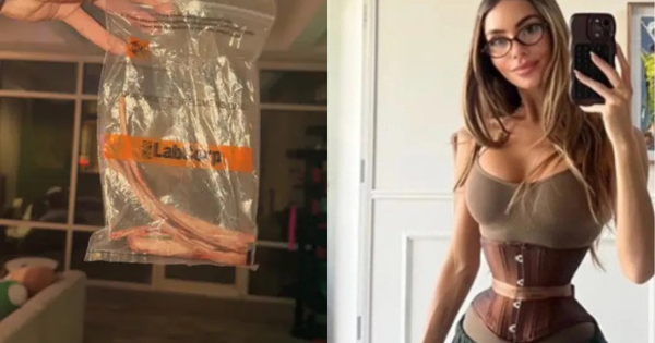 Cô gái 28 tuổi chi 362 triệu, cắt 6 xương sườn để có vòng eo con kiến - trào lưu thẩm mỹ kinh hoàng quay trở lại avatar1764938608715 1764938609193342076014png