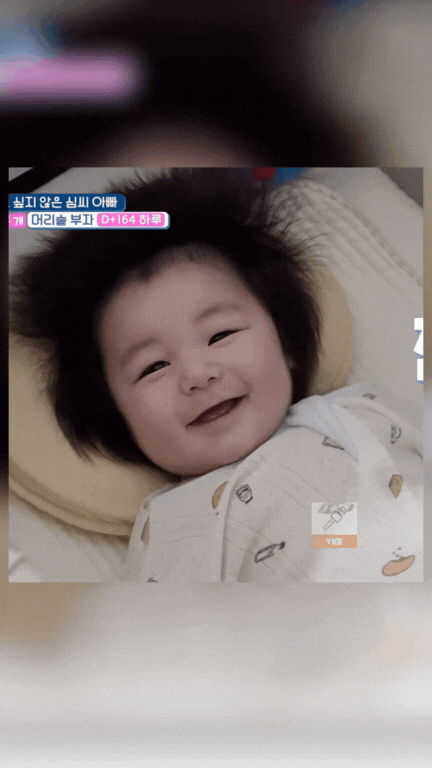 MXH phát cuồng vì bé Haru: 5 tháng tuổi siêu nhiều tóc, gương mặt