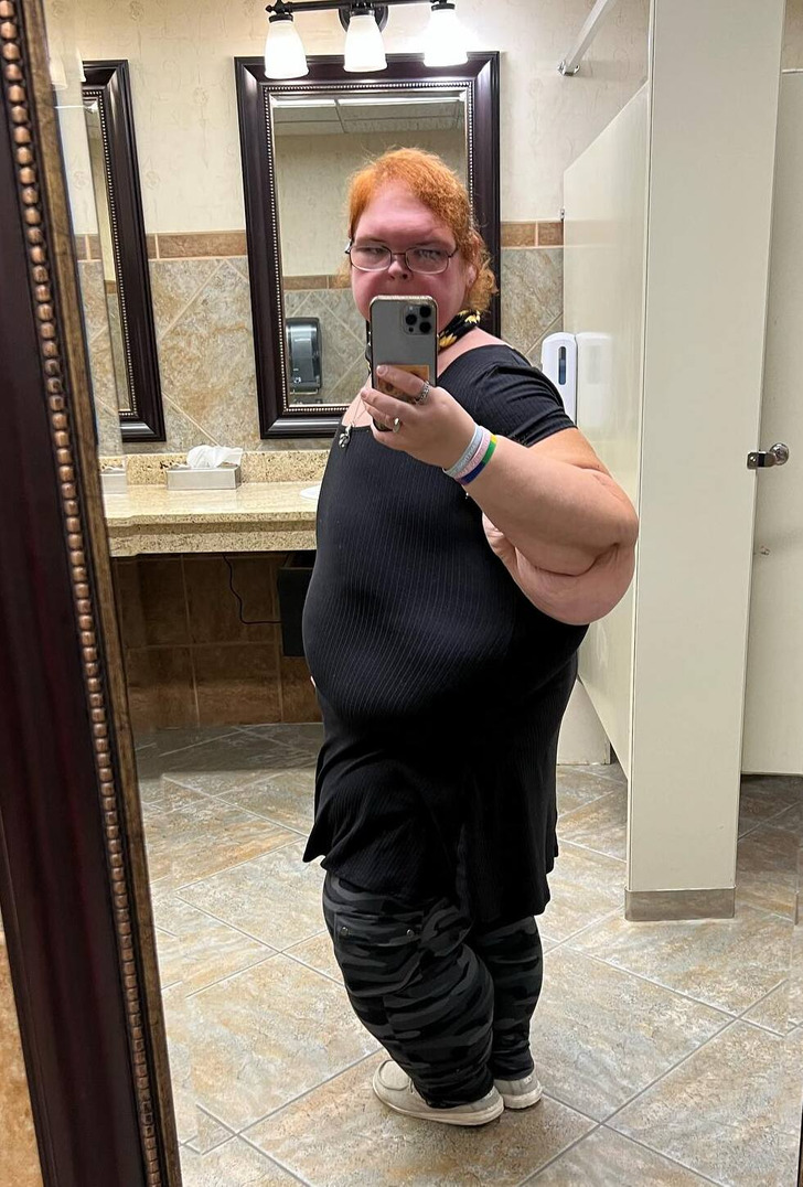 Người phụ nữ nặng 329kg, béo đến mức từng nguy kịch đến tính mạng