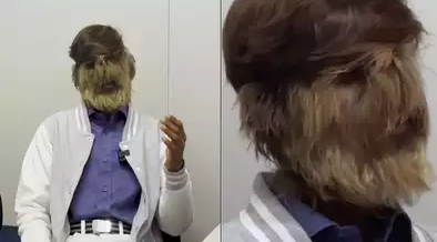 Chàng trai 18 tuổi lông mọc đầy mặt lập kỷ lục Guinness- Ảnh 1. Chàng trai 18 tuổi lông mọc đầy mặt lập kỷ lục Guinness- Ảnh 1.