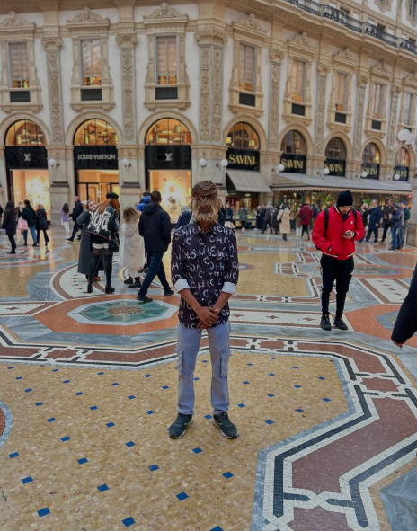 Chàng trai 18 tuổi lông mọc đầy mặt lập kỷ lục Guinness- Ảnh 2. Chàng trai 18 tuổi lông mọc đầy mặt lập kỷ lục Guinness- Ảnh 2.