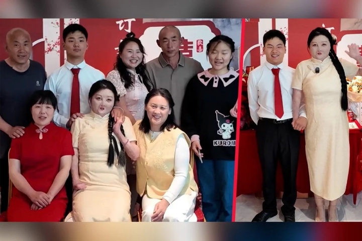 Cô gái bị bỏng 95% cơ thể tiết lộ điều trùng hợp đặc biệt với chồng sắp cưới- Ảnh 2.