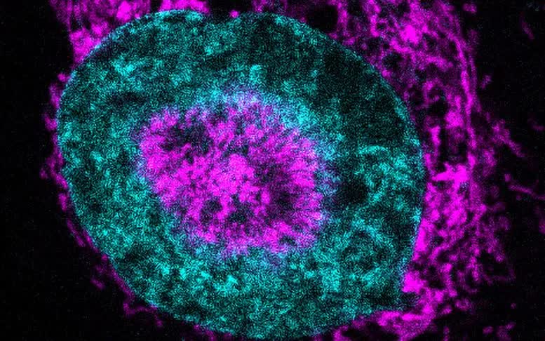 Hình ảnh một tế bào ung thư bị giới hạn (Ảnh: Centro de Regulación Genómica)