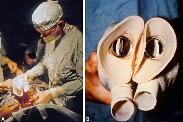 Ngày định mệnh của y học hiện đại: Ca cấy ghép tim nhân tạo đầu tiên trên thế giới và hành trình vượt qua giới hạn sự sống- Ảnh 2.