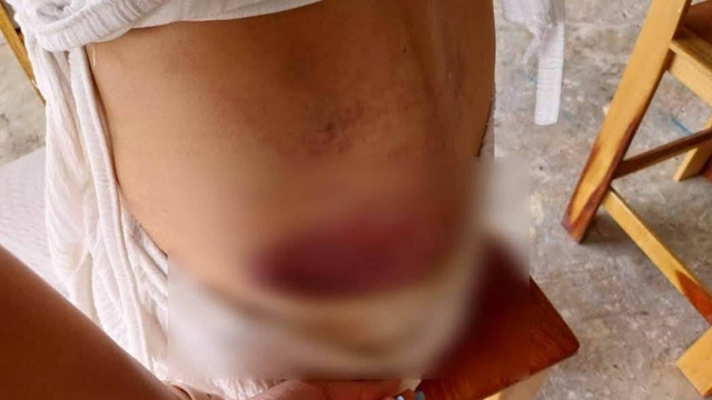 Bạn trai qua lại với 6 phụ nữ khác, cô gái hỏi đến liền bị đối phương tấn công, phải nhảy khỏi ban công- Ảnh 3. Bạn trai qua lại với 6 phụ nữ khác, cô gái hỏi đến liền bị đối phương tấn công, phải nhảy khỏi ban công- Ảnh 3.