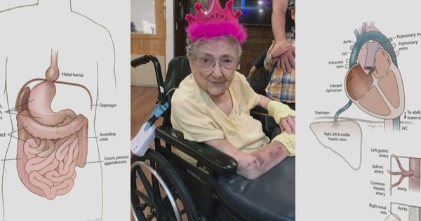 Người phụ nữ sống khỏe mạnh 99 năm với nội tạng đảo ngược trong bụng: Những gì diễn ra trong phòng khám nghiệm thi thể gây chấn động d b9dcd92f0ed51920x1080 1749627267905656741973 0 80 1080 1808 crop 1749627324392902614058 1749631763606 1749631763837984933970 0 0 477 764 crop 1749631781580135783673jpg