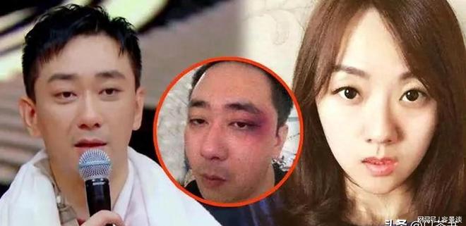 Nam MC kêu cứu vì bị vợ bạo hành hơn 100 lần, 8 lần trọng thương nhập viện!- Ảnh 4.