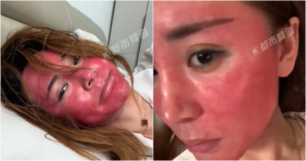 Khuôn mặt của người phụ nữ 22 năm không tẩy trang gây sốc- Ảnh 1.