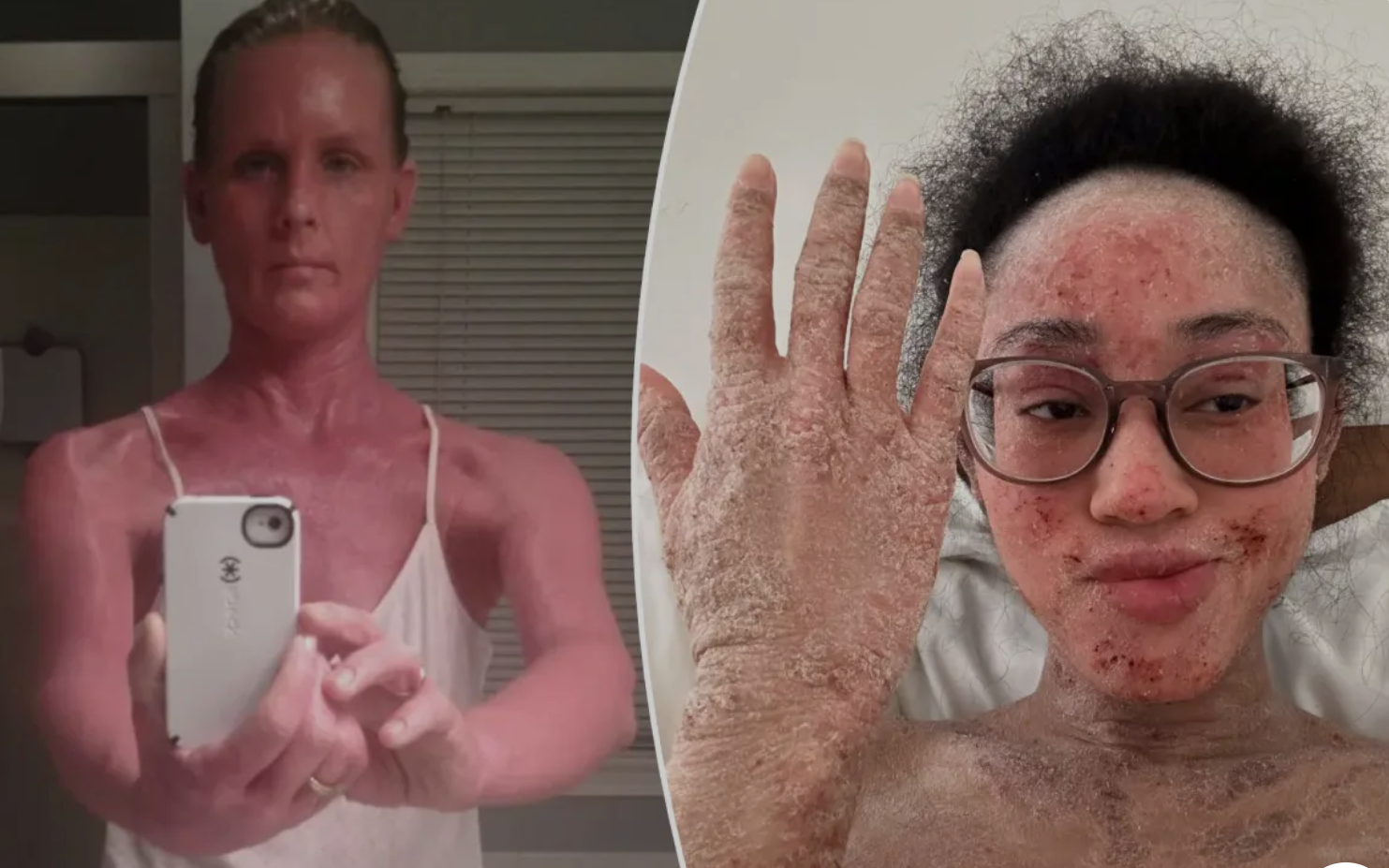 Câu chuyện về nỗi ám ảnh ‘nửa sống nửa chết’ vì loại thuốc hàng triệu người tin dùng- Ảnh 3.