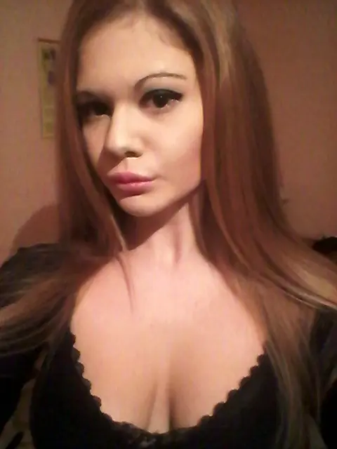 Lộ ảnh trước phẫu thuật gây sốc của “người phụ nữ có đôi môi lớn nhất thế giới”: Ai nấy đều sửng sốt- Ảnh 3.