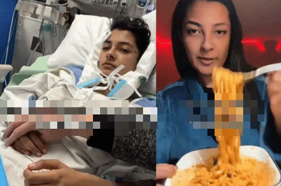 Ăn mì cay đến mức thủng dạ dày, nữ streamer