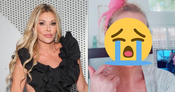 Nữ diễn viên mặt bị "ăn mòn" từng mảng, biến dạng nghiêm trọng vì lí do gì? ejrk 1755346199622819513029 0 0 418 669 crop 17553462039891198818826 1755354728245 17553547287752013125702 0 0 400 764 crop 1755354806523606888600jpg