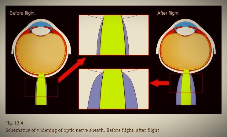 Trở về Trái đất sau chuyến du hành vũ trụ, đôi mắt của nhiều phi hành gia đã thay đổi- Ảnh 2.