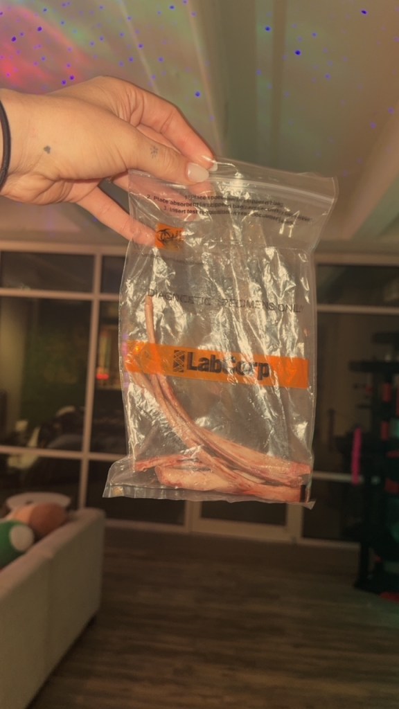 Cô gái 28 tuổi chi 362 triệu, cắt 6 xương sườn để có vòng eo con kiến - trào lưu thẩm mỹ kinh hoàng quay trở lại- Ảnh 2.