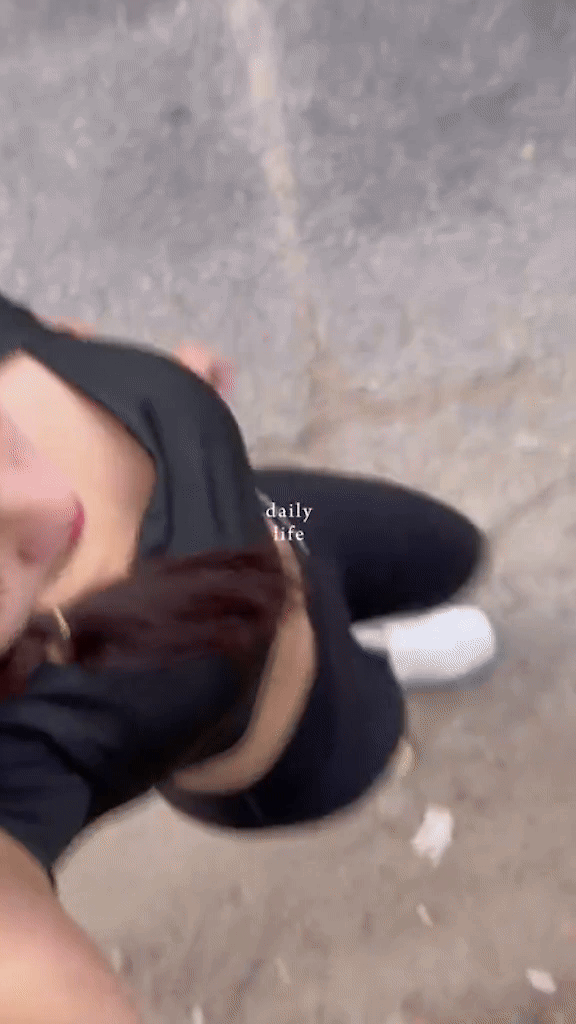 Tình trạng của Á hậu Vbiz 2K1 sau khi phẫu thuật loại bỏ khối u trong ống sống ngoài tủy- Ảnh 1.