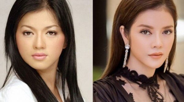 Lý Nhã Kỳ kiện người đồn cô "sửa nát mặt" 27 Lý Nhã Kỳ kiện người đồn cô "sửa nát mặt" ezgif 4973cb63b7a950 1744422465 344 width740height495 auto cropjpg