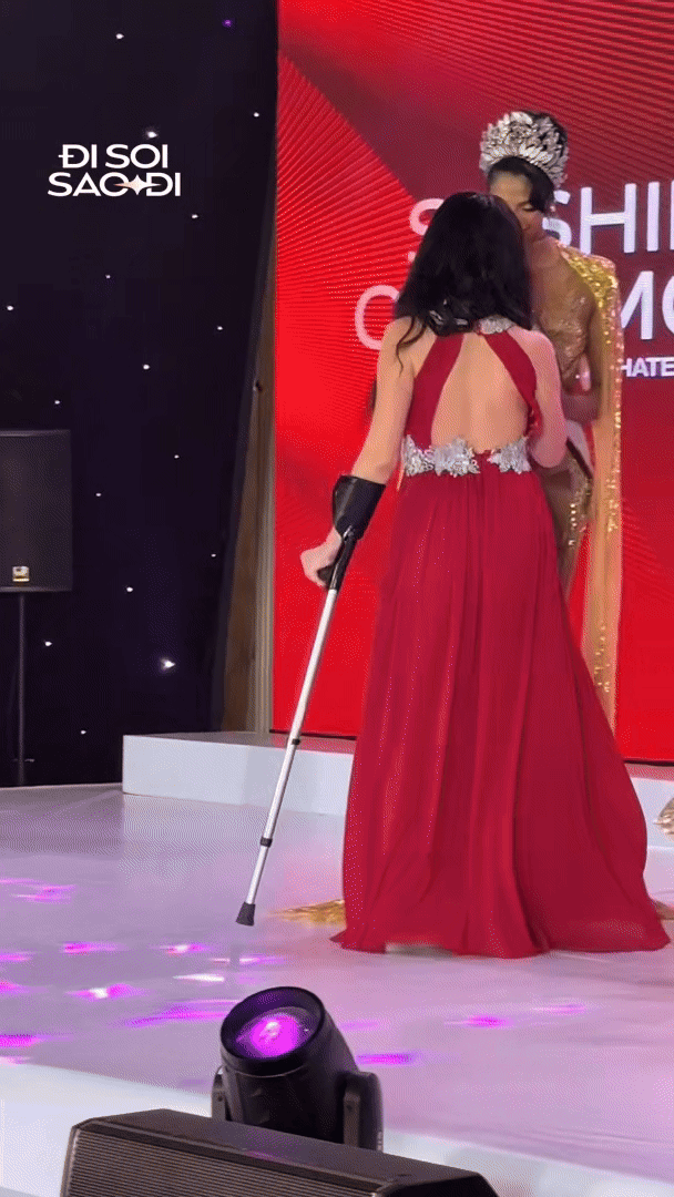 Vì sao Miss Charm Pháp chống nạng tập tễnh trong lễ trao sash tại Việt Nam?- Ảnh 2.