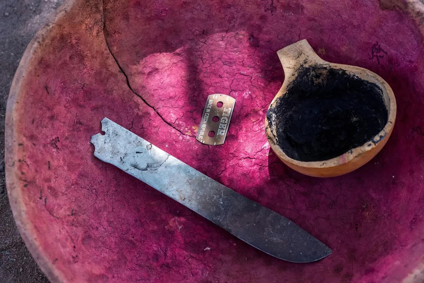 Vết sẹo vĩnh viễn từ hủ tục cắt bộ phận sinh dục nữ: Vì sao hàng trăm triệu bé gái và phụ nữ vẫn phải gánh chịu nỗi đau rùng mình đến tận ngày nay?- Ảnh 2. Vết sẹo vĩnh viễn từ hủ tục cắt bộ phận sinh dục nữ: Vì sao hàng trăm triệu bé gái và phụ nữ vẫn phải gánh chịu nỗi đau rùng mình đến tận ngày nay?- Ảnh 2.