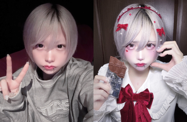 14 triệu người sững sờ trước màn thẩm mỹ như