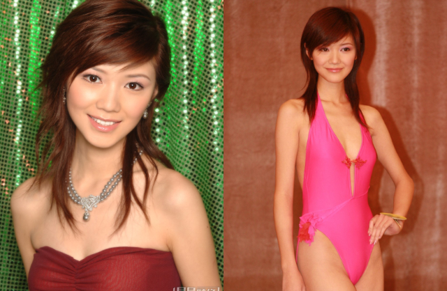 1 Hoa hậu 8X nhập viện cấp cứu vì đột ngột mất thị giác sau khi đắp mặt nạ dưỡng da- Ảnh 3.