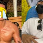 Kinh hoàng vụ nam diễn viên bị "con nghiện" chém trọng thương, phải khâu hơn 100 mũi khắp cơ thể fotojet 2025 07 04t124747785 17516138841161949819191 0 0 335 640 crop 17516139064271637651017jpg