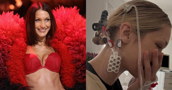 Em gái siêu mẫu của Gigi Hadid vật vã đau đớn vì căn bệnh nguy hiểm liên quan đến não fotojet 2025 09 20t103913147 17583425527782098904716 0 0 335 640 crop 17583425633432006336239jpg