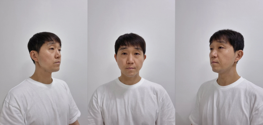 "Em trai Duk Sun" Reply 1988 sống thế nào sau 9 năm mắc ung thư máu? fotojet 3 1756632632960675911026 1756635018711 17566350190872106856809