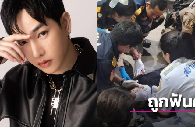 Rùng mình nam ca sĩ 8X bất ngờ bị đâm vào mặt ngay tại trạm xăng- Ảnh 1.