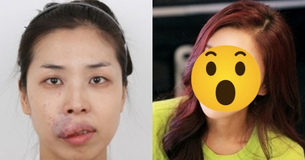 Cô gái vô danh khiến cả showbiz sững sờ với màn "vịt hoá thiên nga" thành mỹ nhân đẹp như búp bê fotojet 74 1764642964942128720921 0 0 335 640 crop 1764642969296779983631jpg