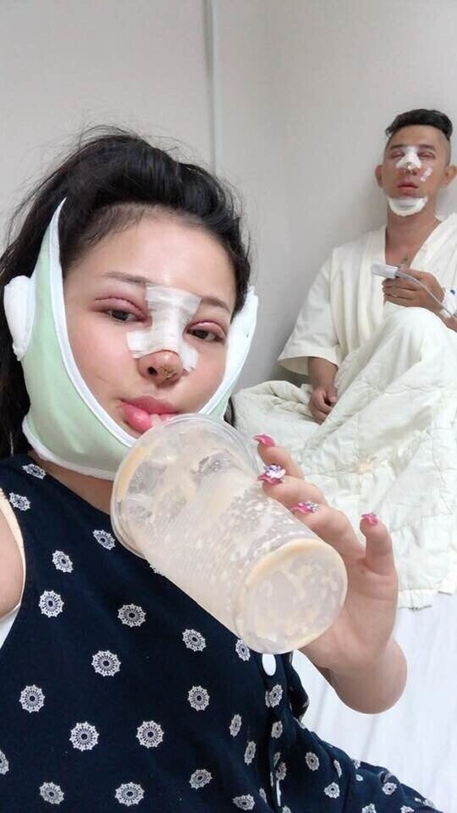 Ngân 98 và những cú lộ mặt mộc gây sốc tâm lý- Ảnh 13.