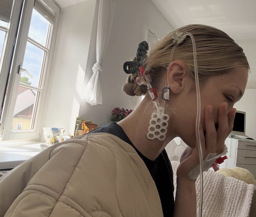 Em gái siêu mẫu của Gigi Hadid vật vã đau đớn vì căn bệnh nguy hiểm liên quan đến não- Ảnh 6.