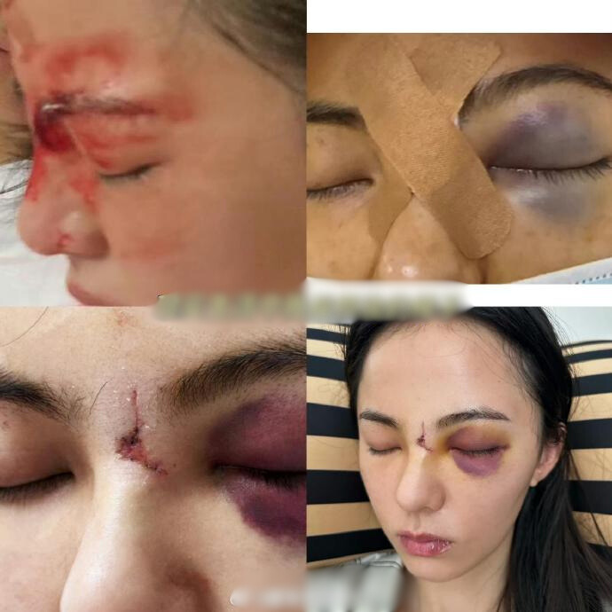 Phim cổ trang drama nhất 2025: Dàn sao bị cả nước tẩy chay, sốc nhất là che giấu tai nạn chết người- Ảnh 5.