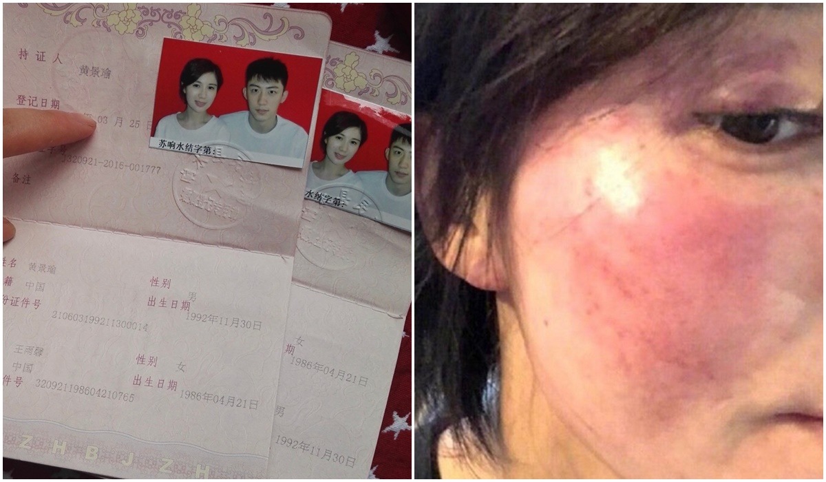 Mỹ nam lộ clip đưa gái lạ đi Phú Quốc bị vợ cũ tố cáo bạo hành đến biến dạng mặt mũi, sảy thai- Ảnh 4.